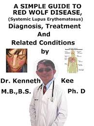 Most patients have times when the disease is active. A Simple Guide To Red Wolf Disease Systemic Lupus Erythematosus Diagnosis Treatment And Related Conditions Kindle Edition By Kee Kenneth Professional Technical Kindle Ebooks Amazon Com