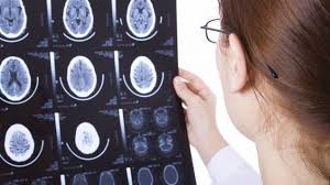 Meningeom Symptome Therapie Prognose Nach Operation Onmeda De