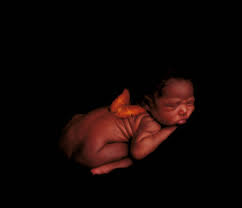 Maybe you would like to learn more about one of these? Anne Geddes Wants Your Baby Pictures The New York Times