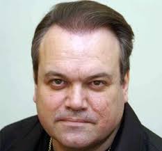 Shaun Williamson Hair Transplant Results