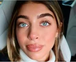 Its unusual these days to see a naturally beautiful young woman who hasn't  had lip fillers or tattoos 🤣