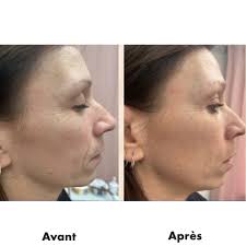 Médico-Esthétique Annie Lapointe