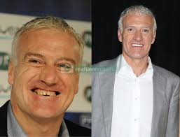 Didier deschamps claimed he was happy enough with a point after world champions france were held by a wonderful hungary side at euro 2020. Didier Deschamps New Teeth Realtime Images