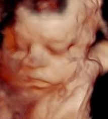 Baby reaches three pounds milestone