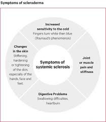 Systemic flaws in the design and construction of the vehicles. Systemic Sclerosis Scleroderma Versus Arthritis