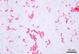 Image result for Dysuria