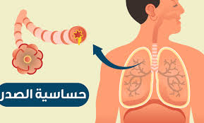 اشهر ادوية حساسية الصدر للكبار والصغار والدواء المناسب Medicine Chest Movie Posters Medicine