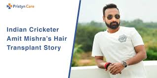 Amit mishra singer was born on 15 february 1989 in lucknow, uttar pradesh, india. Indian Cricketer Amit Mishra S Hair Transplant Story Pristyn Care