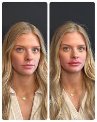 Audrey Blount (@_aestheticsbyaudrey_np) • Instagram ਫੋਟੋਆਂ ਅਤੇ ਵੀਡੀਓਜ਼