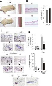 Although some clinical trials were done using the drug delivery effect of microneedle on patients with alopecia, no previous study showed the therapeutic effect of microneedle itself on hair growth by wounding 1, 10, 11. Influence Of Trs On Hair Growth A Skin Phenotype Of Wild Type Wt Download Scientific Diagram