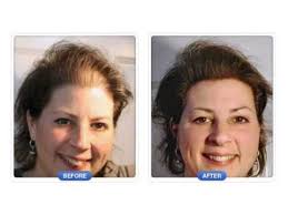 We did not find results for: Quelle Coupe Pour Cheveux Tres Fins Et Clairsemes