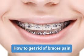 Our formula gets rid of ingredients that can cause different forms of acne. 38 Braces Ideas Braces Braces Tips Getting Braces