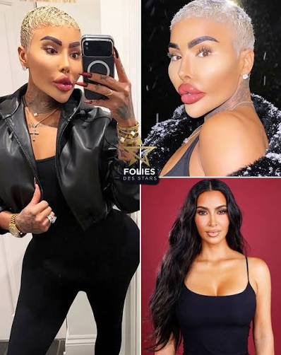 Folies - 🚨💔 L'influenceur Jordan James Parke est décédé à l'âge de 34 ans  !😳 Il était connu pour avoir dépensé plus de 150 000 $ en chirurgie  esthétique afin de ressembler