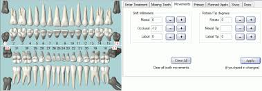 Open Dental Software Tooth Movements