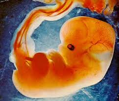 Obat aborsi cytotec 200 mcg solusi tepat untuk cara menggugurkan kandungan 1 2 3 4 5 6 7 8 bulan secara alami dan ampuh tanpa gagal. Usia Kandungan 2 Bulan Berbentuk Apa Seputar Bentuk