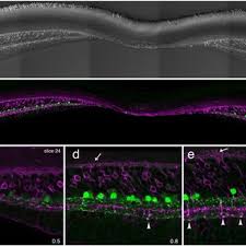 He also recycles metal sheets, thick wires and nails used in construction, and he completes the elaborate sculpture. Pdf Aii Amacrine Cells In The Primate Fovea Contribute To Photopic Vision