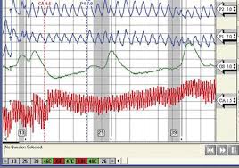 As an officer in the department's internal affairs and polygraph unit, he conducted thousands of polygraph tests. Los Angeles Polygraph Lie Detector Test From 150
