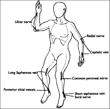 Lateral incisions are made on both sides of chest 2. Sites Of Escharotomy Incision Dotted Lines With Particular Attention Download Scientific Diagram
