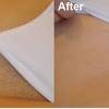Wondering what kind of results you can expect from bikini area or brazilian style laser hair removal treatments at milan? 1