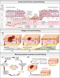 Image result for Wound Repair