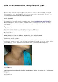 The abnormal cells begin multiplying in your anaplastic thyroid cancer can be the most severe type, because it's aggressive in spreading to other parts of the body. What Are The Causes Of An Enlarged Thyroid Gland