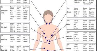 example of tumor markers markers reference site diagram