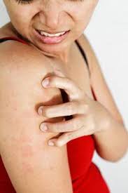 A skin allergy is often a reaction to foreign substance and your immune system produces antibodies to fight. Home Remedies For Skin Rashes Natural Home Treatments For Itchy And Irritated Skin