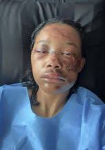 Headline Heat: Nya Lee Responds To Headlines About Shady Plastic Surgeon,  Beef With Cardi B & More