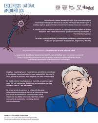 Tratamiento precoz mejora síntomas incapacitantes. Esclerosis Lateral Amiotrofica Salud Facmed