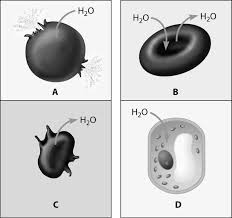 When placed in a hypertonic solution, a red blood cell will lose water and undergo crenation (shrivel). Final Exam Flashcards Easy Notecards