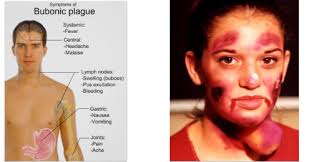Occasionally, the swollen lymph nodes, known as buboes m. Pneumonic Plague Bubonic Plague Buboes Pictures Savvy
