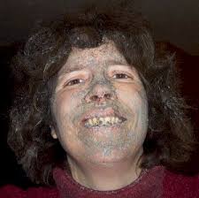 Sled Dog Central: Vote for your favorite Mushing Disease Photo Caption