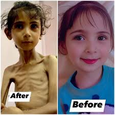 We were speaking to @nahed_hajjaj99 today and he told us his legs couldnt  even get him up today from the hunger. This is the story of over 1.8  million people in Gaza.