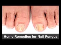 cure toenail fungus with apple cider