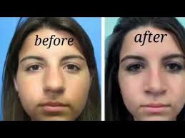 How To Make Nose Smaller Naturally Make Nose Smaller Nose Reshaping Nose Contouring Makeup