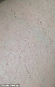 Personally, i've discontinued the nono and started using another hair removal system that works better for me and. Femail Tries Out The Best Home Hair Removal Products Daily Mail Online