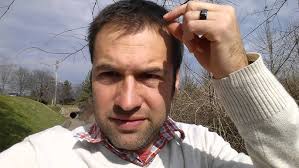 At Age 19, My Receding Hairline Began