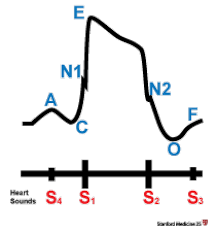 Image result for Point of Maximum Impulse