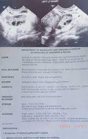 Pelvic ultrasound codes are used for both female and male anatomy. A 33 Year Old Female Presents With Roundglass Curofy Facebook