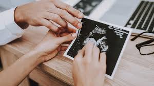 Femurlange Tabelle Berechnung Der Babygrosse Hallo Eltern