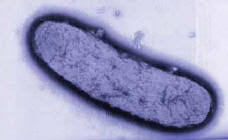 Image result for yersinia fotos