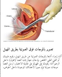 Qamislo Rojava Posts Facebook