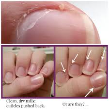 It is an extension of the nail plate that overlaps the hyponychium. Invisible Cuticle As Your Nail Grows Out A Thin Layer Of Cuticle Can Grow Along On Top Of The Nail This Thin Layer Of Sk Ongles Ongles Ecole Idees Manucure