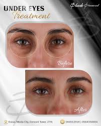 Weekend vibes, endless smiles Dr. Sina Ali keeps the joy flowing! ready for  more magic next week! Book your free consultation with Our Smile Makeover  Expert @dr.sina_ali @blackdiamonddc @dr.sina_ali For Bookings please