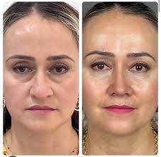 Departamento de Rinología, Cirugía Plástica Facial y Medicina Estética