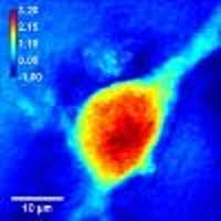 Maybe you would like to learn more about one of these? Diffraction Phase Microscopy Principles And Applications In Materials And Life Sciences Osa