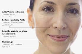 A typical juvederm treatment can cost as low as $450 for injection for those options with no lidocaine. Juvederm Faqs What It Does Cost More
