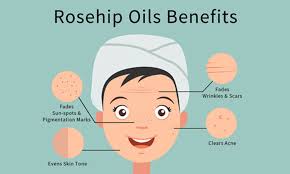 The use of rosehip oil for hair growth is beneficial because: Benefits Of Rosehip Oil For Hair And Skin Skin Beauty