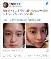 小島瑠璃子「変顔にするアプリじゃないよ」 親知らず抜歯後ショットにネット驚き ／2021年4月8日 - 写真 - エンタメ - ニュース - クランクイン！