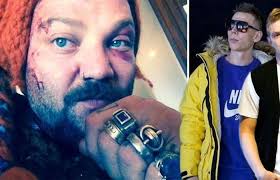 10 of the smelliest rappers in hollywood. Icelandic Rappers Sick Chirpse